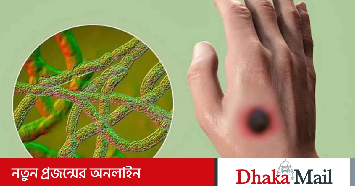 Xotin erini belbog‘ bilan qiynoqqa solmoqda (foto)