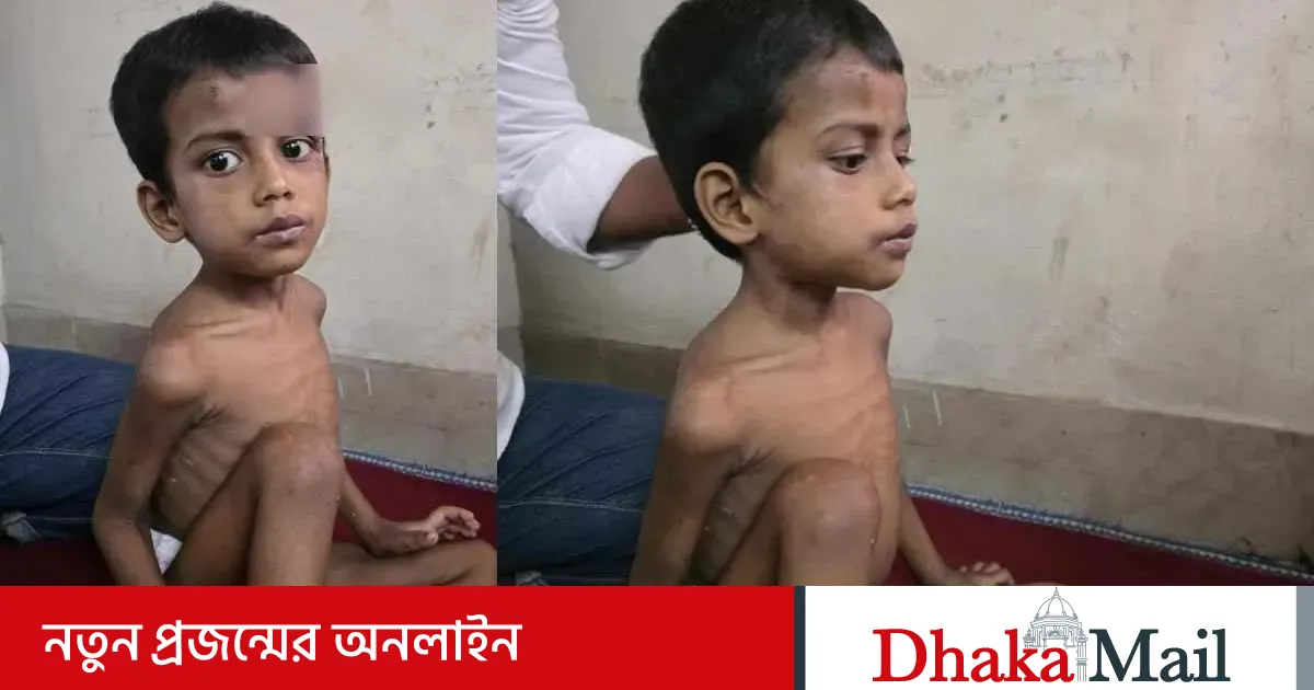 Oshiq boshchani tishlab oldi Oshiq boshchani tishlab oldi